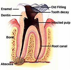 Tooth